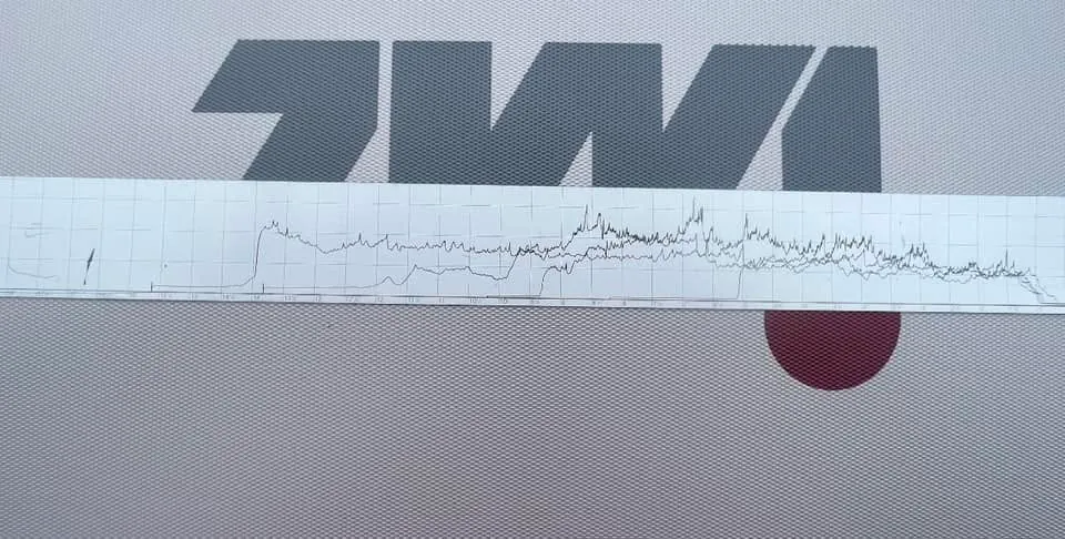 IML-RESI resistograph density reading strip from a rotted 56-inch tulip poplar trunk, Godhans tree risk assessment Jacksonville NC