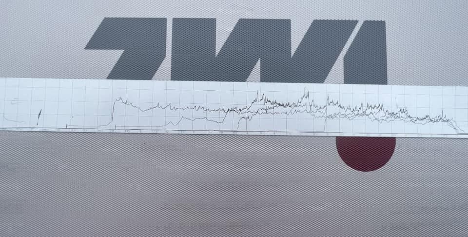 Resistograph density printout from a pecan tree test, Onslow County, NC